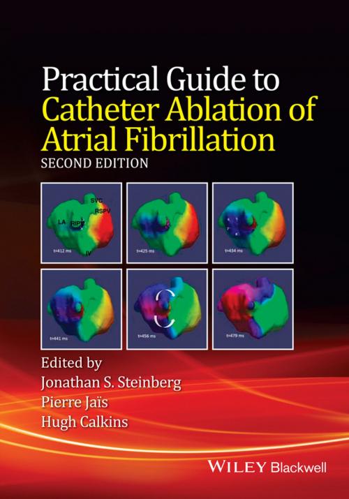Cover of the book Practical Guide to Catheter Ablation of Atrial Fibrillation by Jonathan S. Steinberg, Pierre Jais, Hugh Calkins, Wiley