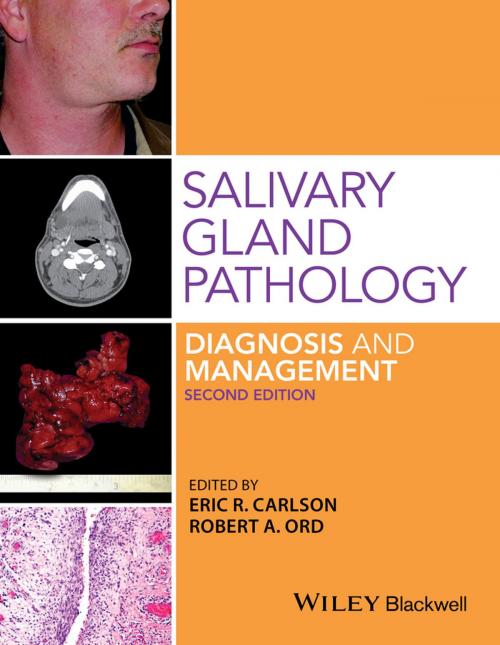 Cover of the book Salivary Gland Pathology by Robert A. Ord, Eric R. Carlson, Wiley