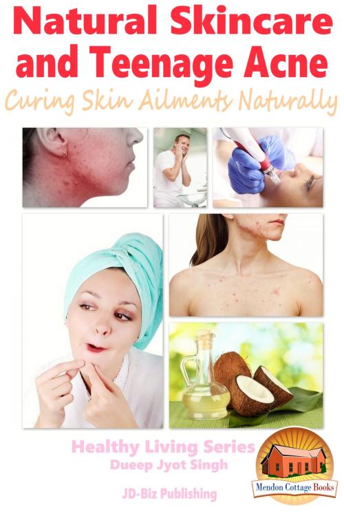 Cover of the book Natural Skincare and Teenage Acne: Curing Skin Ailments Naturally by Dueep Jyot Singh, Mendon Cottage Books