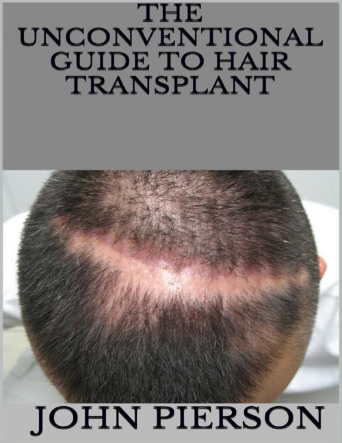 Cover of the book The Unconventional Guide to Hair Transplant by John Pierson, Lulu.com