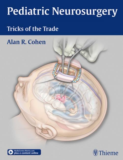 Cover of the book Pediatric Neurosurgery: Tricks of the Trade by Alan Cohen, Thieme