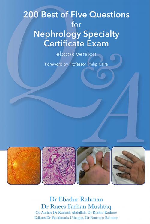 Cover of the book 200 Best of Five Questions for Nephrology Specialty Certificate Exam with Revision Notes and Guidelines by Raees Farhan Mushtaq, Ebadur Rahman, Uthappa Editor, Tricorn Books