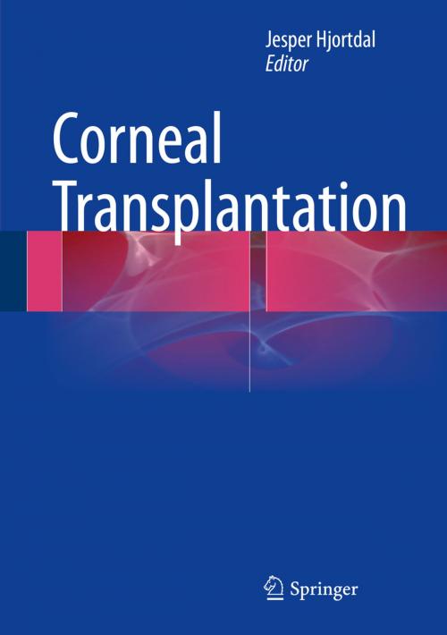 Cover of the book Corneal Transplantation by , Springer International Publishing