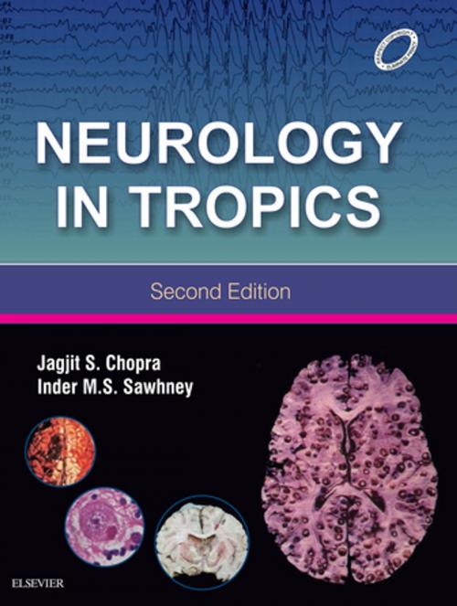 Cover of the book Neurology in Tropics (E-book) by , Elsevier Health Sciences