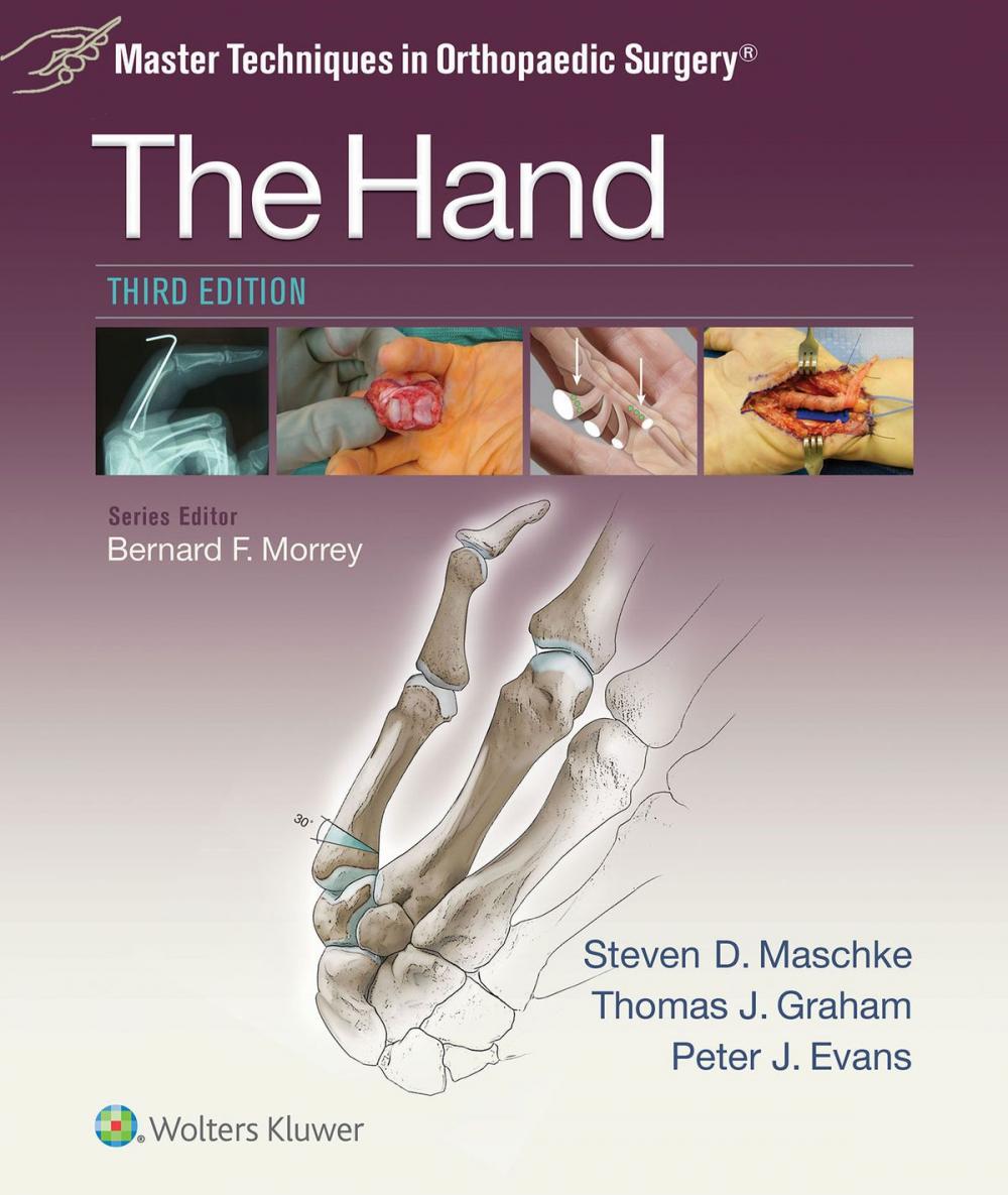 Big bigCover of Master Techniques in Orthopaedic Surgery: The Hand