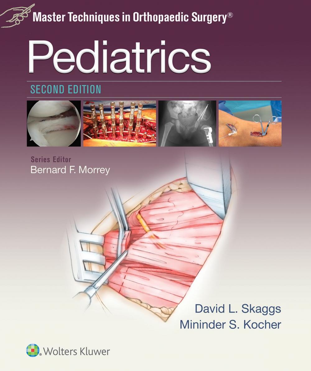 Big bigCover of Master Techniques in Orthopaedic Surgery: Pediatrics
