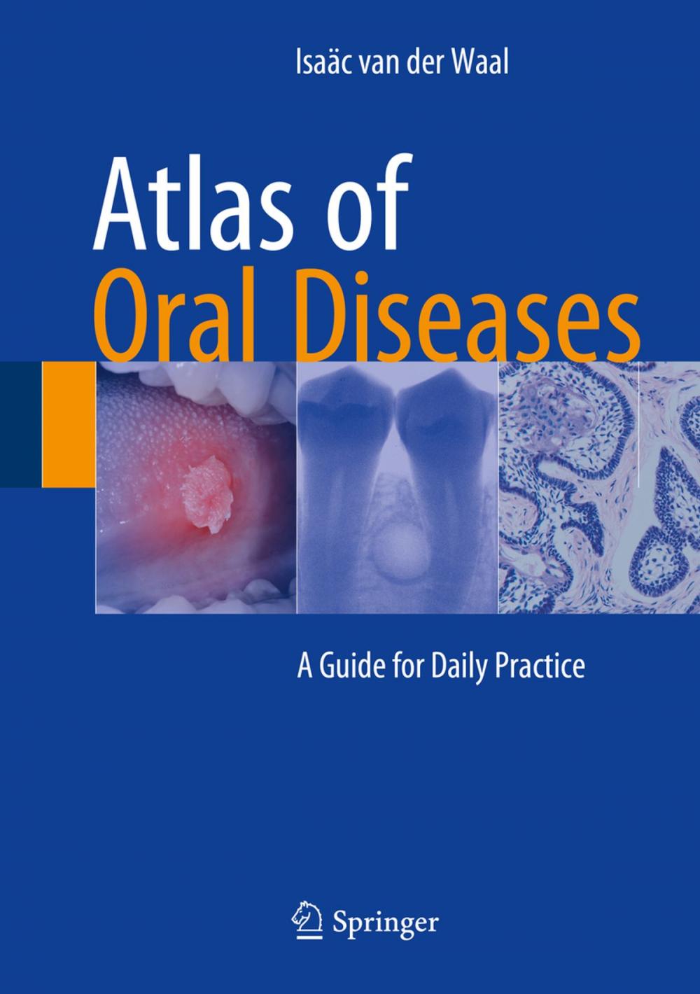 Big bigCover of Atlas of Oral Diseases