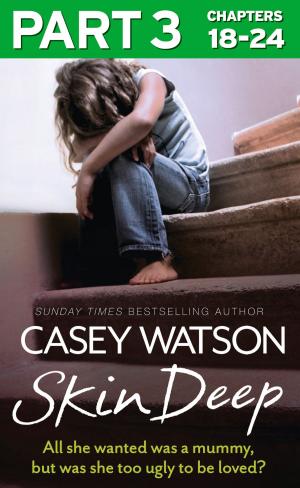 Cover of the book Skin Deep: Part 3 of 3: All she wanted was a mummy, but was she too ugly to be loved? by Summer Waters