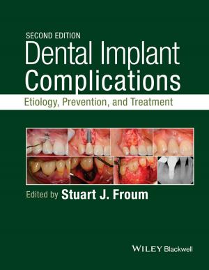 Cover of the book Dental Implant Complications by Bernard J. Healey, Kenneth T. Walker