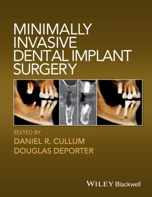 Cover of the book Minimally Invasive Dental Implant Surgery by Karlins