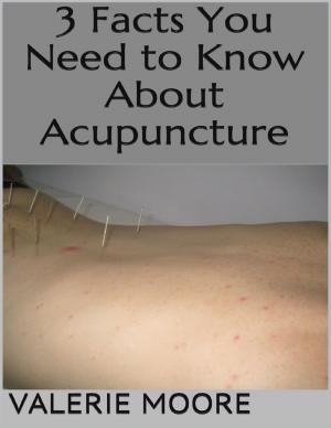 Book cover of 3 Facts You Need to Know About Acupuncture