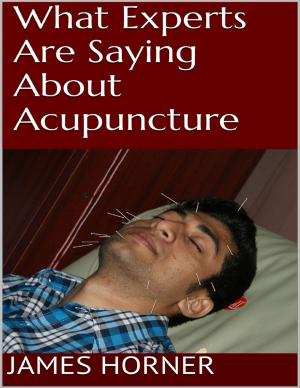 bigCover of the book What Experts Are Saying About Acupuncture by 
