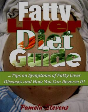 Cover of the book Fatty Liver Diet Guide: Tips on Symptoms of Fatty Liver Disease and How You Can Reverse It! by Vanessa Wallace