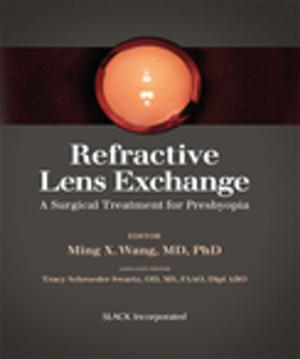 Cover of the book Refractive Lens Exchange by Robert Lowe, Francis Farraye
