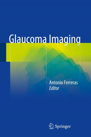 Cover of the book Glaucoma Imaging by Andreas Öchsner, Resam Makvandi