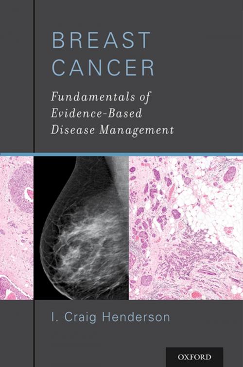 Cover of the book Breast Cancer by I. Craig Henderson, MD, Oxford University Press