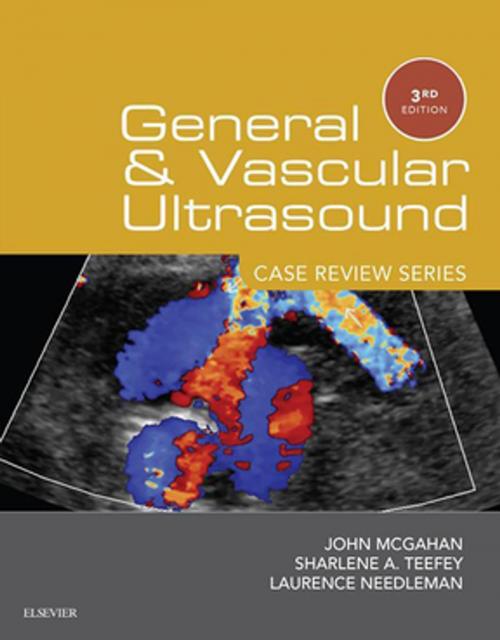 Cover of the book General and Vascular Ultrasound: Case Review Series E-Book by Sharlene A Teefey, MD, John P. McGahan, MD, Laurence Needleman, MD, Elsevier Health Sciences