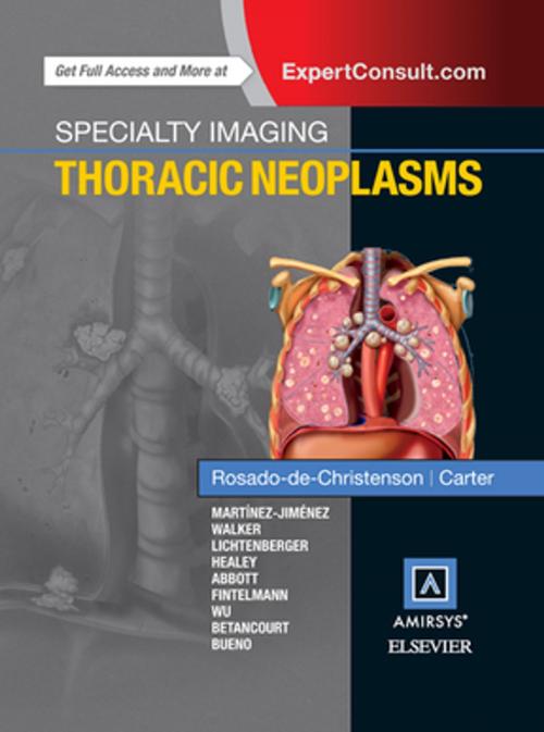 Cover of the book Specialty Imaging: Thoracic Neoplasms E-Book by Melissa L. Rosado-de-Christenson, MD, FACR, Brett W. Carter, MD, Elsevier Health Sciences
