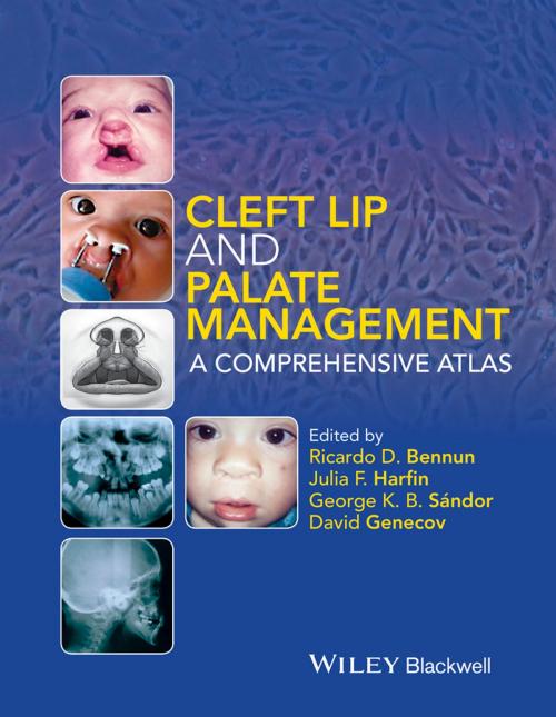 Cover of the book Cleft Lip and Palate Management by George K. B. Sándor, David Genecov, Wiley