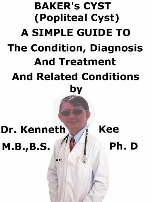 Cover of the book Baker’s Cyst, (Popliteal Cyst) A Simple Guide To The Condition, Diagnosis, Treatment And Related Conditions by Kenneth Kee, Kenneth Kee