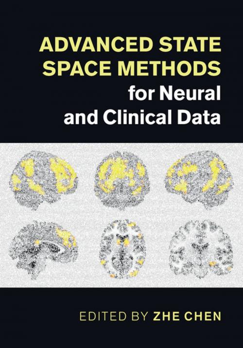 Cover of the book Advanced State Space Methods for Neural and Clinical Data by , Cambridge University Press