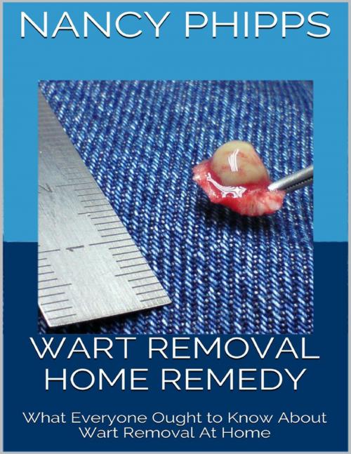 Cover of the book Wart Removal Home Remedy: What Everyone Ought to Know About Wart Removal At Home by Nancy Phipps, Lulu.com