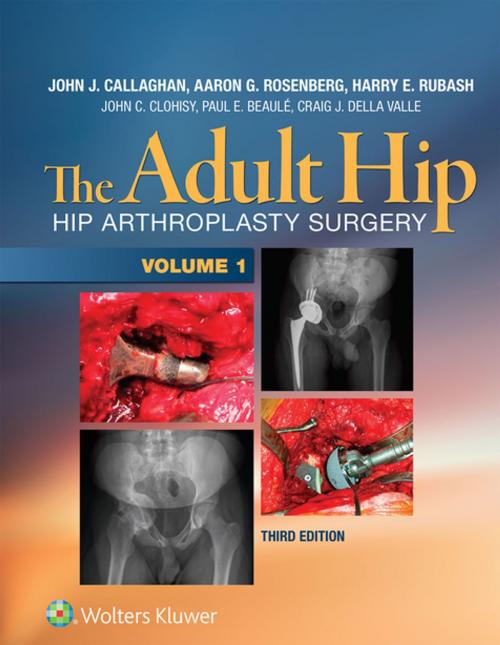 Cover of the book The Adult Hip by John J. Callaghan, Aaron G. Rosenberg, Harry E. Rubash, John Clohisy, Paul Beaule, Craig DellaValle, Wolters Kluwer Health