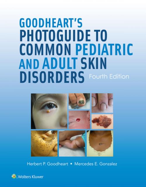 Cover of the book Goodheart's Photoguide to Common Pediatric and Adult Skin Disorders by Herbert Goodheart, Mercedes Gonzalez, Wolters Kluwer Health