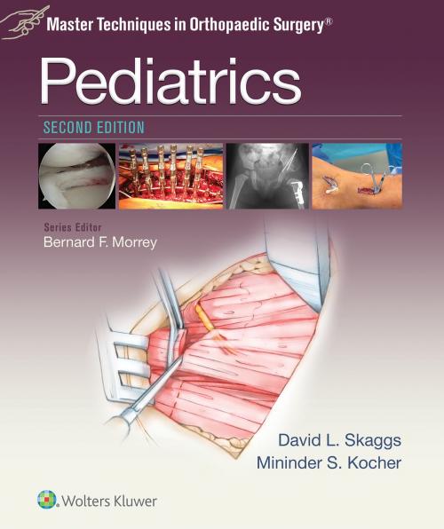 Cover of the book Master Techniques in Orthopaedic Surgery: Pediatrics by David L. Skaggs, Mininder Kocher, Wolters Kluwer Health