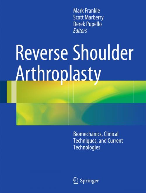 Cover of the book Reverse Shoulder Arthroplasty by , Springer International Publishing