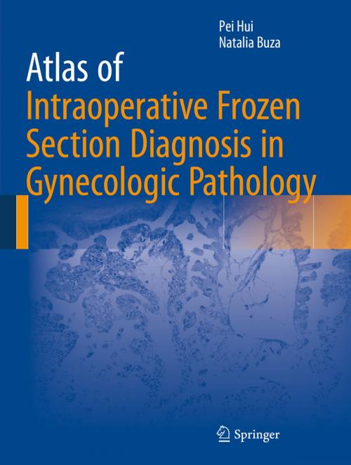Cover of the book Atlas of Intraoperative Frozen Section Diagnosis in Gynecologic Pathology by Pei Hui, Natalia Buza, Springer International Publishing