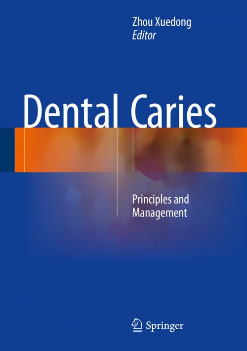 Cover of the book Dental Caries by , Springer Berlin Heidelberg