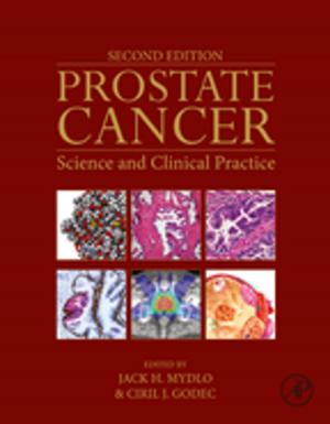 Cover of the book Prostate Cancer by Mukesh Doble, Ken Rollins, Anil Kumar