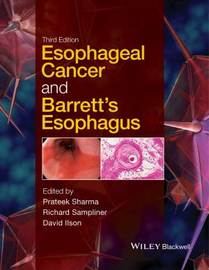 Cover of the book Esophageal Cancer and Barrett's Esophagus by Cary Krosinsky, Nick Robins, Stephen Viederman