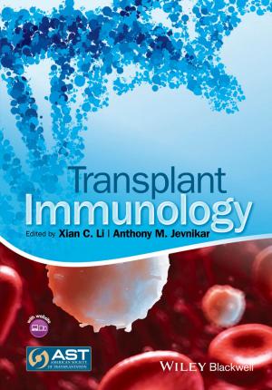 Cover of the book Transplant Immunology by Michael Thurston, Nigel Alderman