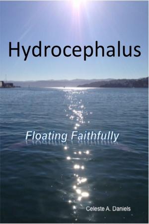 Cover of the book Hydrocephalus: Floating Faithfully by Rodney Ford