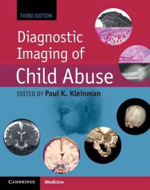 Cover of the book Diagnostic Imaging of Child Abuse by Hugh Elton