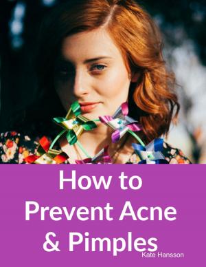 Cover of the book How to Prevent Acne & Pimples by Cathal McCarron