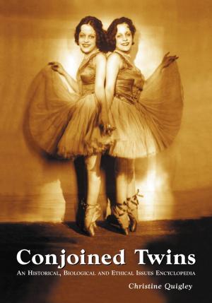 Cover of the book Conjoined Twins by Jean-Denis G.G. Lepage