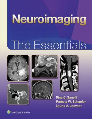 Cover of the book Neuroimaging: The Essentials by Matthew J. Schniederjan