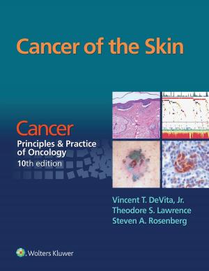 Book cover of Cancer of the Skin