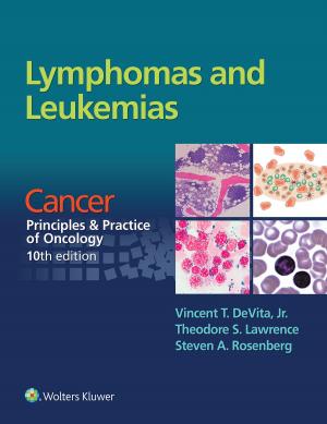 Book cover of Lymphomas and Leukemias