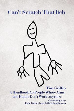 Cover of the book Can't Scratch That Itch by Michael Hailparn