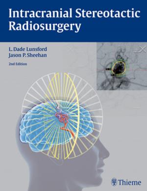 Cover of the book Intracranial Stereotactic Radiosurgery by Hilko Weerda