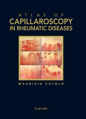 Cover of the book Atlas of capillaroscopy in rheumatic diseases by Elisabeth Viliers, Jelena Ristic