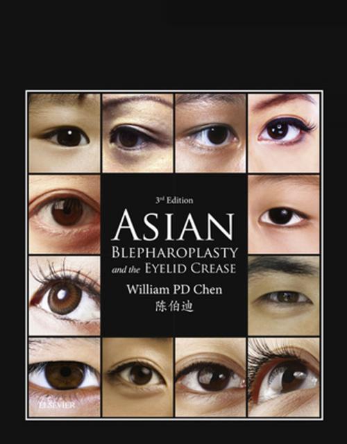 Cover of the book Asian Blepharoplasty and the Eyelid Crease E-Book by William P. Chen, MD, Elsevier Health Sciences