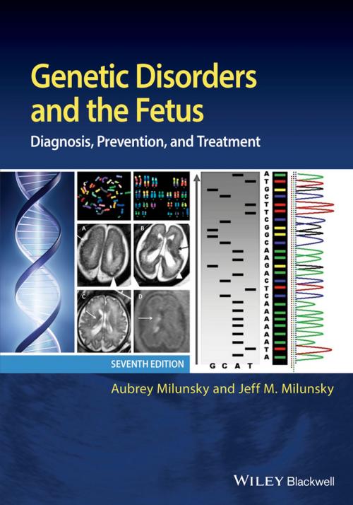 Cover of the book Genetic Disorders and the Fetus by Aubrey Milunsky, Jeff M. Milunsky, Wiley
