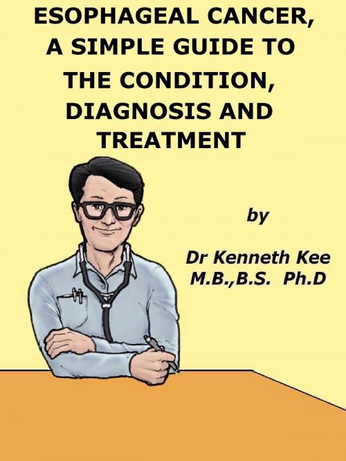 Cover of the book Esophageal Cancer, A Simple Guide To The Condition, Diagnosis And Treatment by Kenneth Kee, Kenneth Kee