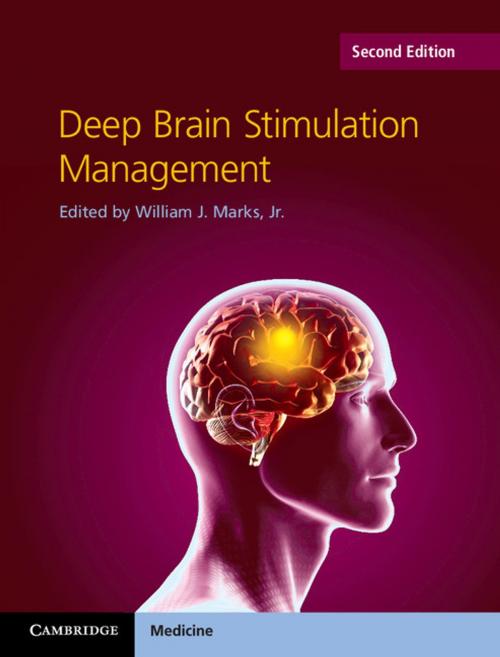 Cover of the book Deep Brain Stimulation Management by , Cambridge University Press
