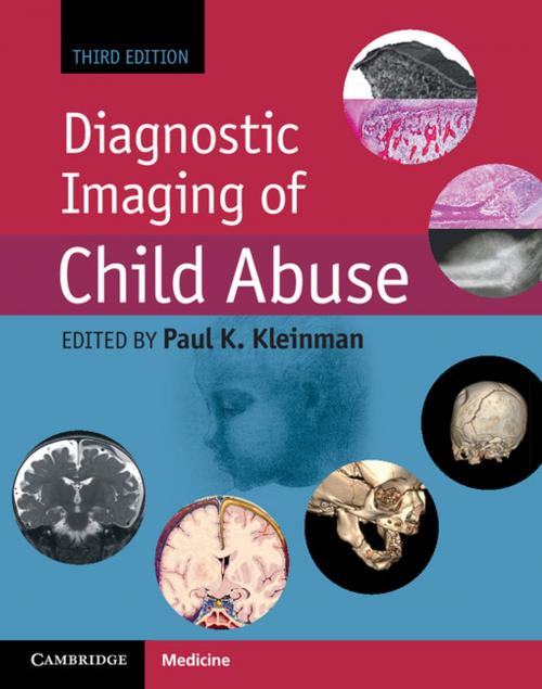 Cover of the book Diagnostic Imaging of Child Abuse by , Cambridge University Press